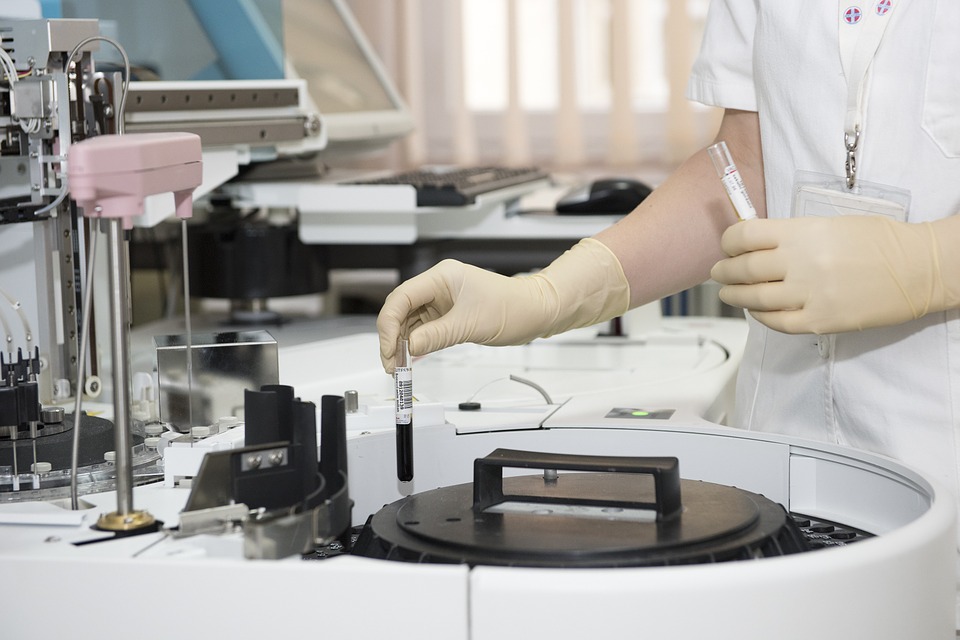 Testosterone in lab check